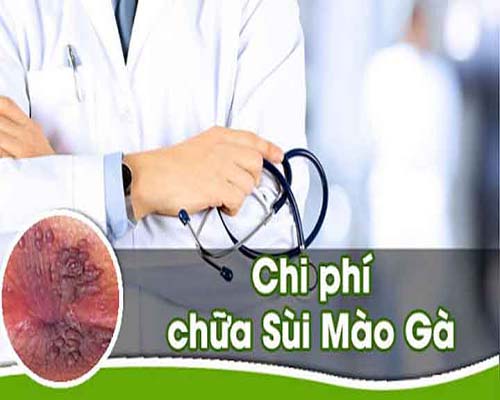 [Tham khảo] Chi phí điều trị bệnh sùi gà chi tiết từng hạng mục