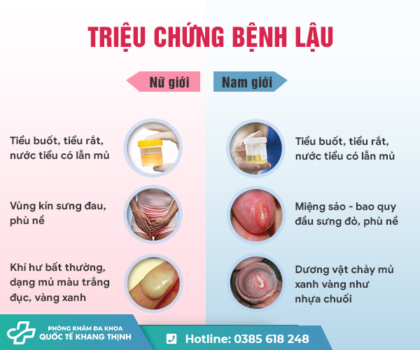 Bệnh lậu ở nam khác gì bệnh lậu ở nữ? So sánh kèm hình ảnh chi tiết