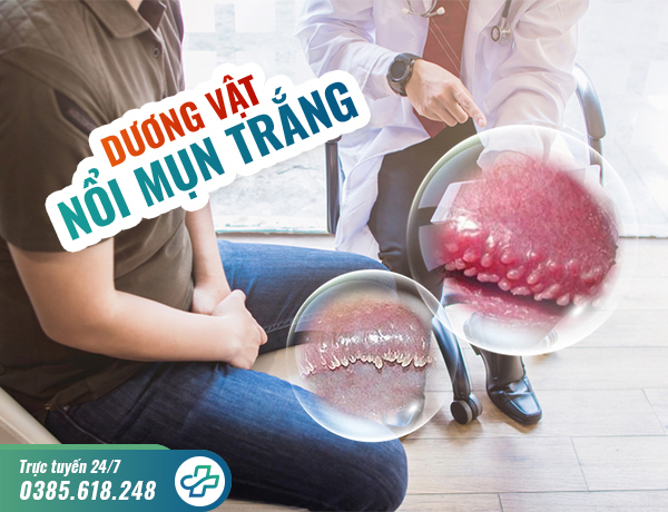 Nổi mụn trắng ở bao quy đầu – Cảnh báo nhiều bệnh lý nguy hiểm
