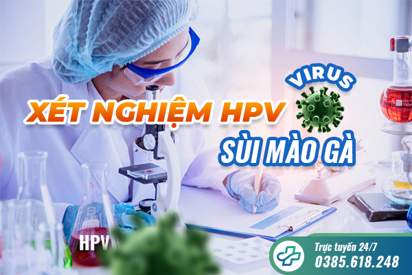 Thủ tục xét nghiệm sùi mào gà địa chỉ xét nghiệm nhanh chóng